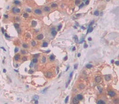 Alpha-1-B-Glycoprotein (a1BG) Polyclonal Antibody - image 4