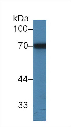 Western Blot; Sample: Recombinant protein.