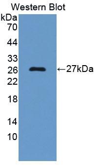 DAB staining on IHC-P; Samples: Bovine Testis Tissue; Primary Ab: 20μg/ml Rabbit Anti-Bovine a1BG Antibody Second Ab: 2µg/mL HRP-Linked Caprine Anti-Rabbit IgG Polyclonal Antibody