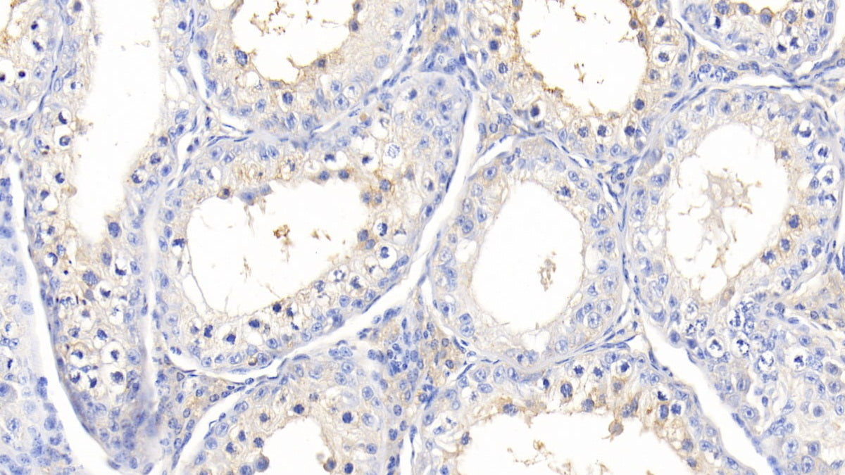 DAB staining on IHC-P; Samples: Bovine Liver Tissue; Primary Ab: 20μg/ml Rabbit Anti-Bovine a1BG Antibody Second Ab: 2µg/mL HRP-Linked Caprine Anti-Rabbit IgG Polyclonal Antibody