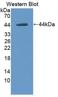 FITC staining on IF; Samples: Human HepG2 Cells;  Primary Ab: 20µg/ml Rabbit Anti-Human HPD Antibody