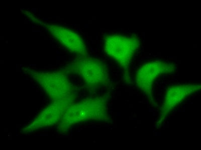 4-Hydroxyphenylpyruvate Dioxygenase (HPD) Polyclonal Antibody - image 4