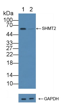 DAB staining on IHC-P; Samples: Human Stomach Tissue; Primary Ab: 20µg/ml Rabbit Anti-Human SHMT2 Antibody Second Ab: 2µg/mL HRP-Linked Caprine Anti-Rabbit IgG Polyclonal Antibody