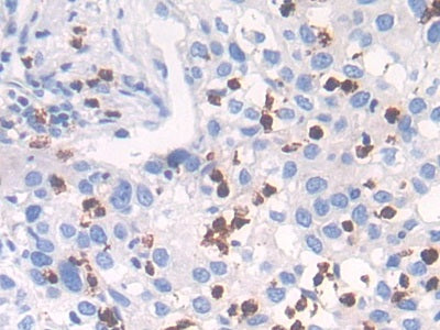 Cathepsin G (CTSG) Polyclonal Antibody - image 5