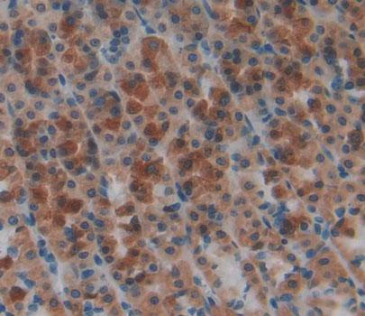 5'-Nucleotidase, Cytosolic III (NT5C3) Polyclonal Antibody - image 3