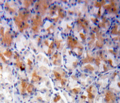 5'-Nucleotidase, Cytosolic III (NT5C3) Polyclonal Antibody - image 3