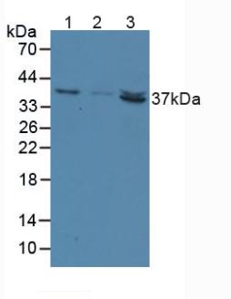 Western Blot; Sample: Recombinant NT5C3, Human.