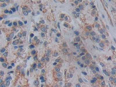DAB staining on IHC-P; Samples: Human Kidney Tissue.