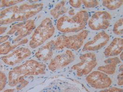 5'-Nucleotidase, Cytosolic III (NT5C3) Polyclonal Antibody - image 5