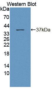 3',5'-Bisphosphate Nucleotidase 1 (BPNT1) Polyclonal Antibody - image 2