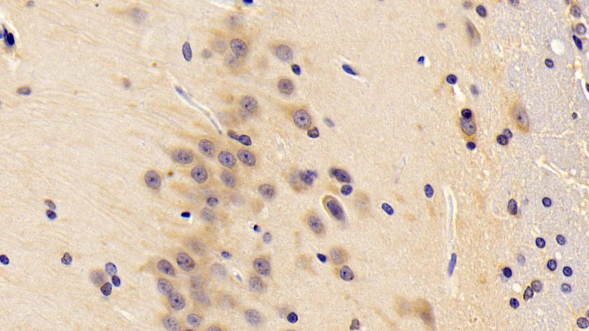 5'-Nucleotidase, Mitochondrial (NT5M) Polyclonal Antibody - image 4