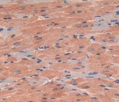 5'-Nucleotidase, Mitochondrial (NT5M) Polyclonal Antibody - image 3