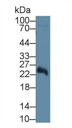 Western Blot; Sample: Recombinant protein.