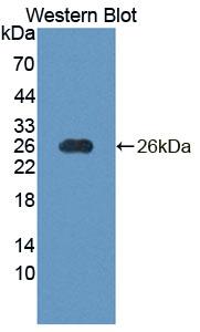 DAB staining on IHC-P; Samples: Human Skeletal muscle Tissue; Primary Ab: 20μg/ml Rabbit Anti-Human NT5M Antibody Second Ab: 2µg/mL HRP-Linked Caprine Anti-Rabbit IgG Polyclonal Antibody