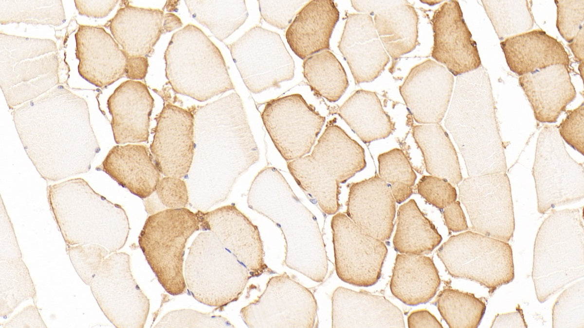 DAB staining on fromalin fixed paraffin- embedded brain tissue)