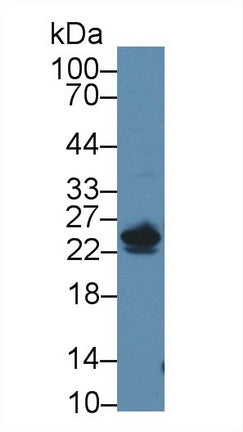 Western Blot; Sample: Recombinant protein.