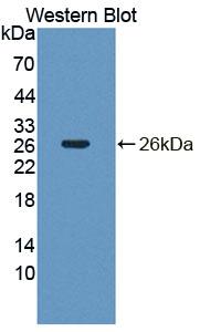 DAB staining on IHC-P; Samples: Mouse Skeletal muscle Tissue;  Primary Ab: 10μg/ml Rabbit Anti-Mouse NT5C Antibody Second Ab: 2µg/mL HRP-Linked Caprine Anti-Rabbit IgG Polyclonal Antibody