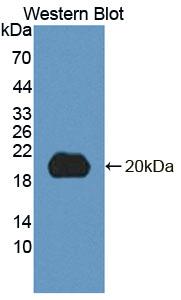 5',3'-Nucleotidase, Cytosolic (NT5C) Polyclonal Antibody - image 2