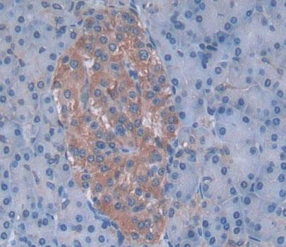 5',3'-Nucleotidase, Cytosolic (NT5C) Polyclonal Antibody - image 3