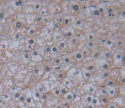 Insulin Receptor Substrate 4 (IRS4) Polyclonal Antibody - image 3
