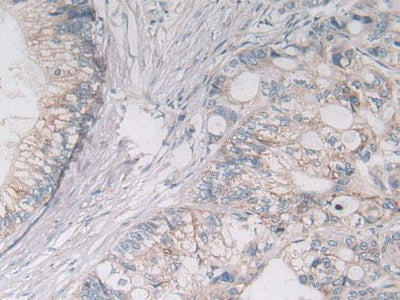 Ornithine Aminotransferase (OAT) Polyclonal Antibody - image 5