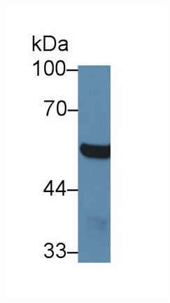 Western Blot; Sample: Recombinant protein.