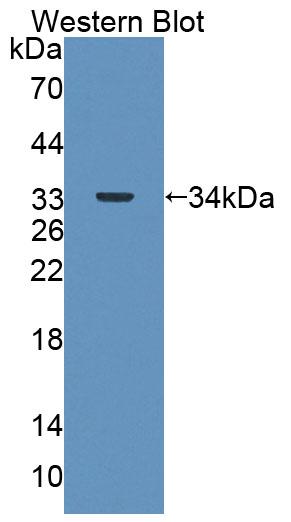 DAB staining on IHC-P; Samples: Mouse Liver Tissue;  Primary Ab: 20µg/ml Rabbit Anti-Mouse ABAT Anti