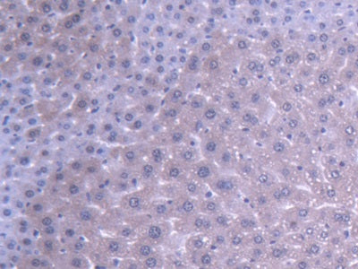 DAB staining on IHC-P; Samples: Mouse Liver Tissue