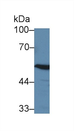 Western Blot; Sample: Recombinant protein.