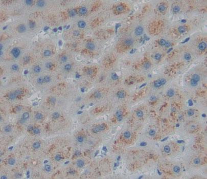 4-Aminobutyrate Aminotransferase (ABAT) Polyclonal Antibody - image 4
