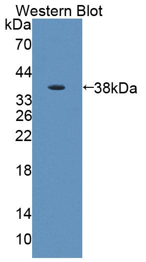 DAB staining on IHC-P; Samples: Mouse Kidney Tissue; Primary Ab: 20μg/ml Rabbit Anti-Mouse AADAT Antibody Second Ab: 2µg/mL HRP-Linked Caprine Anti-Rabbit IgG Polyclonal Antibody