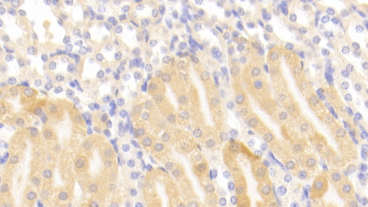 DAB staining on fromalin fixed paraffin- embedded liver tissue)
