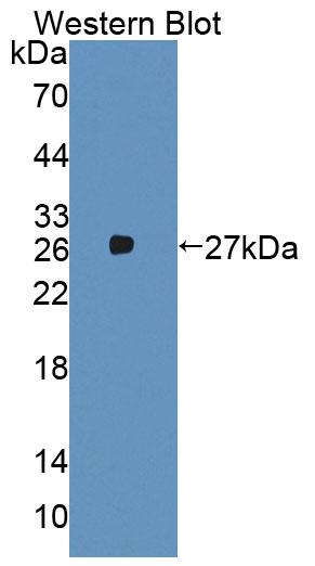 Aminoadipate Aminotransferase (AADAT) Polyclonal Antibody - image 2
