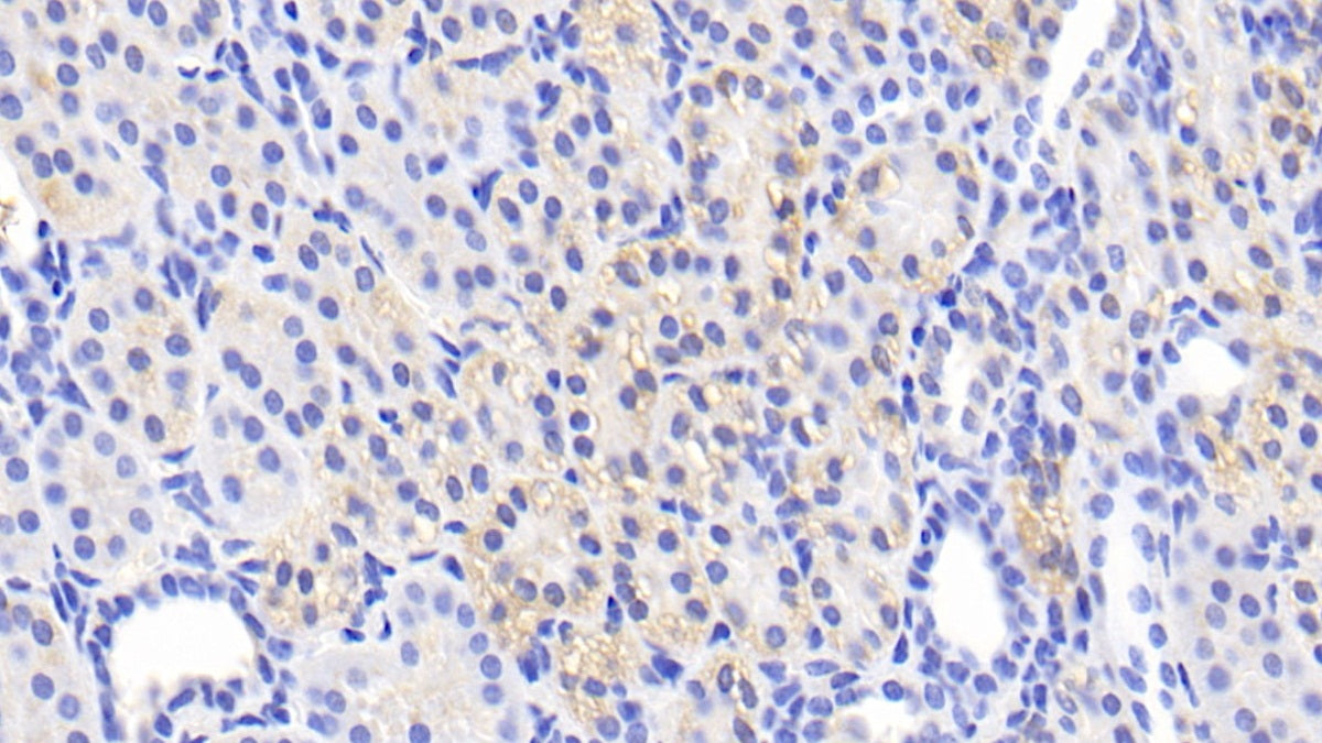 DAB staining on fromalin fixed paraffin- embedded liver tissue)