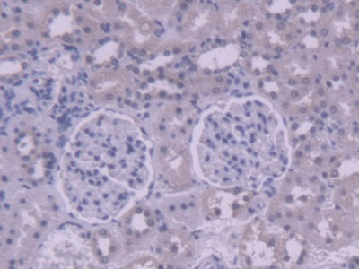 DAB staining on IHC-P; Samples: Rat Heart Tissue.