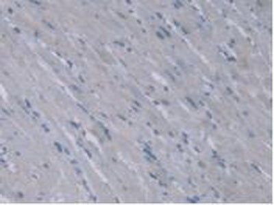 Alanine Glyoxylate Aminotransferase 2 (AGXT2) Polyclonal Antibody - image 5