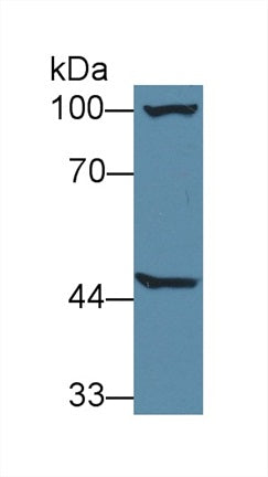 Western Blot; Sample: Recombinant protein.
