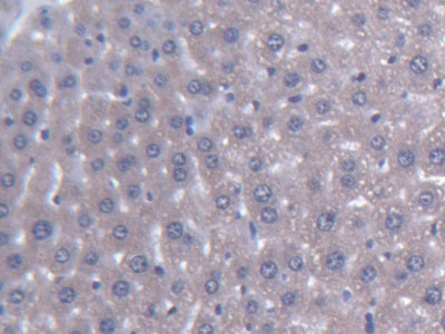 DAB staining on IHC-P; Samples: Mouse Liver Tissue