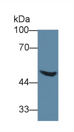 Western Blot; Sample: Recombinant protein.