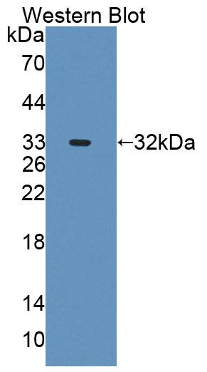 DAB staining on IHC-P; Samples: Human Kidney Tissue;  Primary Ab: 20μg/ml Rabbit Anti-Human AGXT2 Antibody Second Ab: 2µg/mL HRP-Linked Caprine Anti-Rabbit IgG Polyclonal Antibody