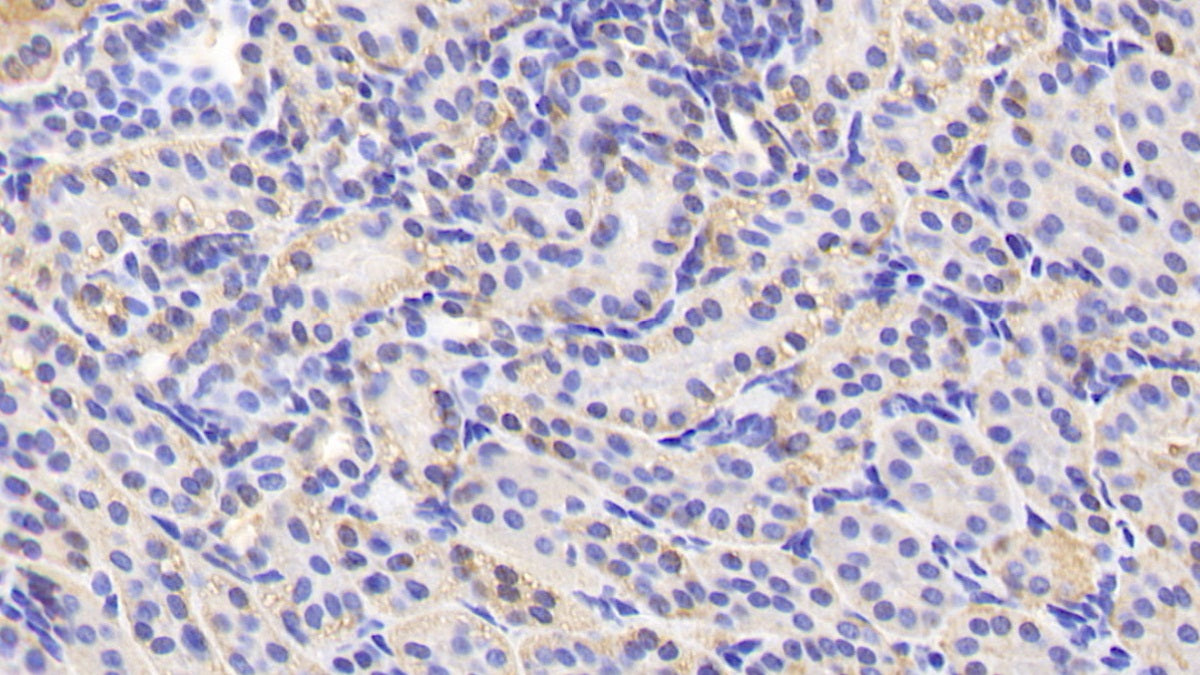 Alanine Glyoxylate Aminotransferase 2 (AGXT2) Polyclonal Antibody - image 4