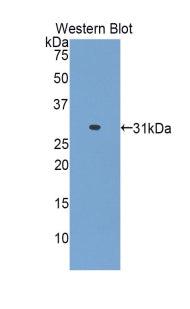 Alanine Aminotransferase 2 (ALT2) Polyclonal Antibody - image 2