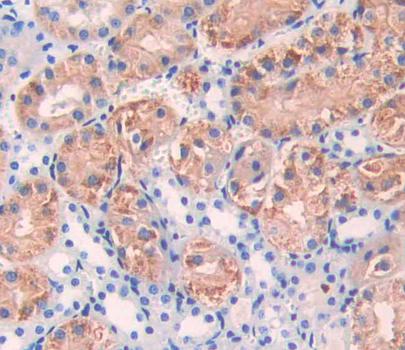 Alanine Aminotransferase 2 (ALT2) Polyclonal Antibody - image 3