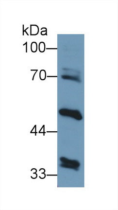 Western Blot; Sample: Recombinant protein.