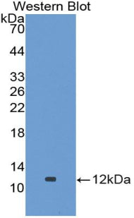 Alanine Aminotransferase 2 (ALT2) Polyclonal Antibody - image 3