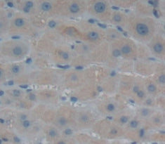 Alanine Aminotransferase 2 (ALT2) Polyclonal Antibody - image 4