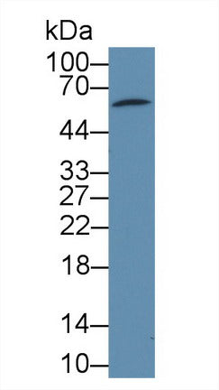 Western Blot; Sample: Recombinant protein.