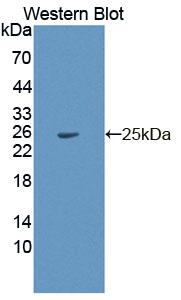DAB staining on IHC-P; Samples: Rat Stomach Tissue; Primary Ab: 20µg/ml Rabbit Anti-Rat PDP2 Antibody Second Ab: 2µg/mL HRP-Linked Caprine Anti-Rabbit IgG Polyclonal Antibody