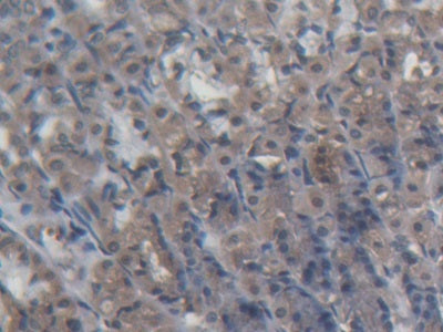 DAB staining on fromalin fixed paraffin- embedded liver tissue)