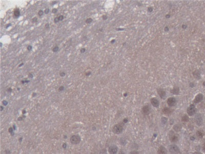 Pyruvate Dehydrogenase Phosphatase 2 (PDP2) Polyclonal Antibody - image 5